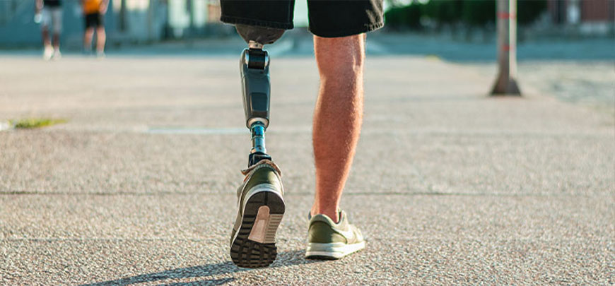 patient experiencing Phantom Limb Syndrome and in need of the neuropathy treatment protocol at Peak Physical Medicine and Wellness in Fort Worth