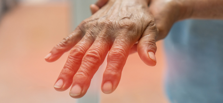 patient experiencing Stabbing & Burning Pain and in need of the neuropathy treatment protocol at Peak Physical Medicine and Wellness in Fort Worth