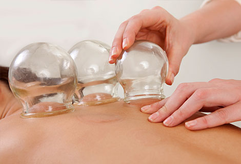 cupping therapy in Fort Worth TX