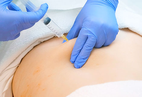 ozone Therapy Fort Worth
