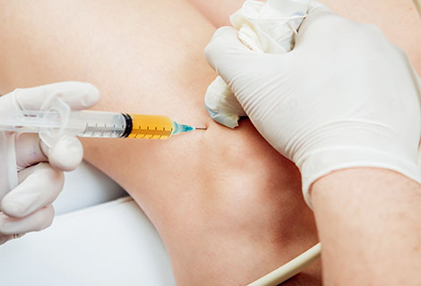 platelet-Rich Plasma Therapy Fort Worth