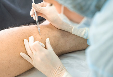 Trigger Point Injections Fort Worth